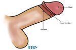Circumcision Styles - Illustrations of High, Low, Tight and 